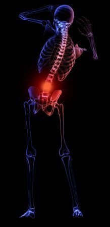 Effet de la méthode Wim Hof sur la spondylarthrite axiale